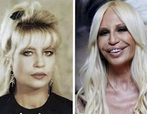 donatella versace perchè è cambiata|donatella versace face what happened.